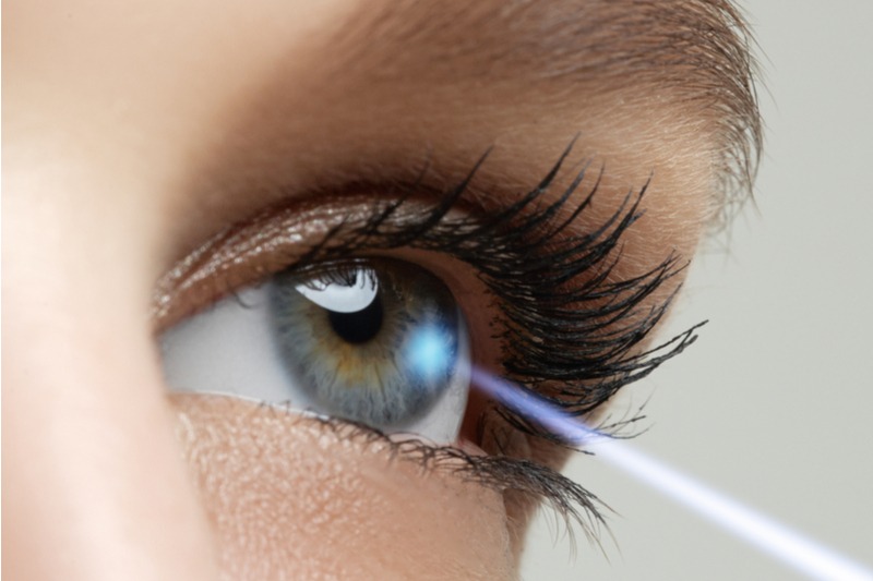 Ako prebieha laserová operácia očí